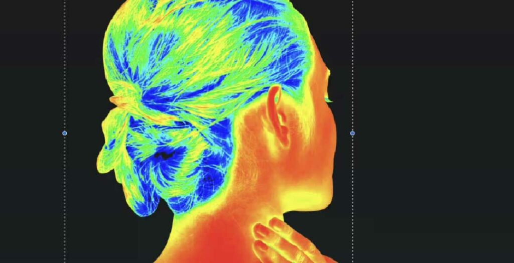 Thermography image of woman's head.